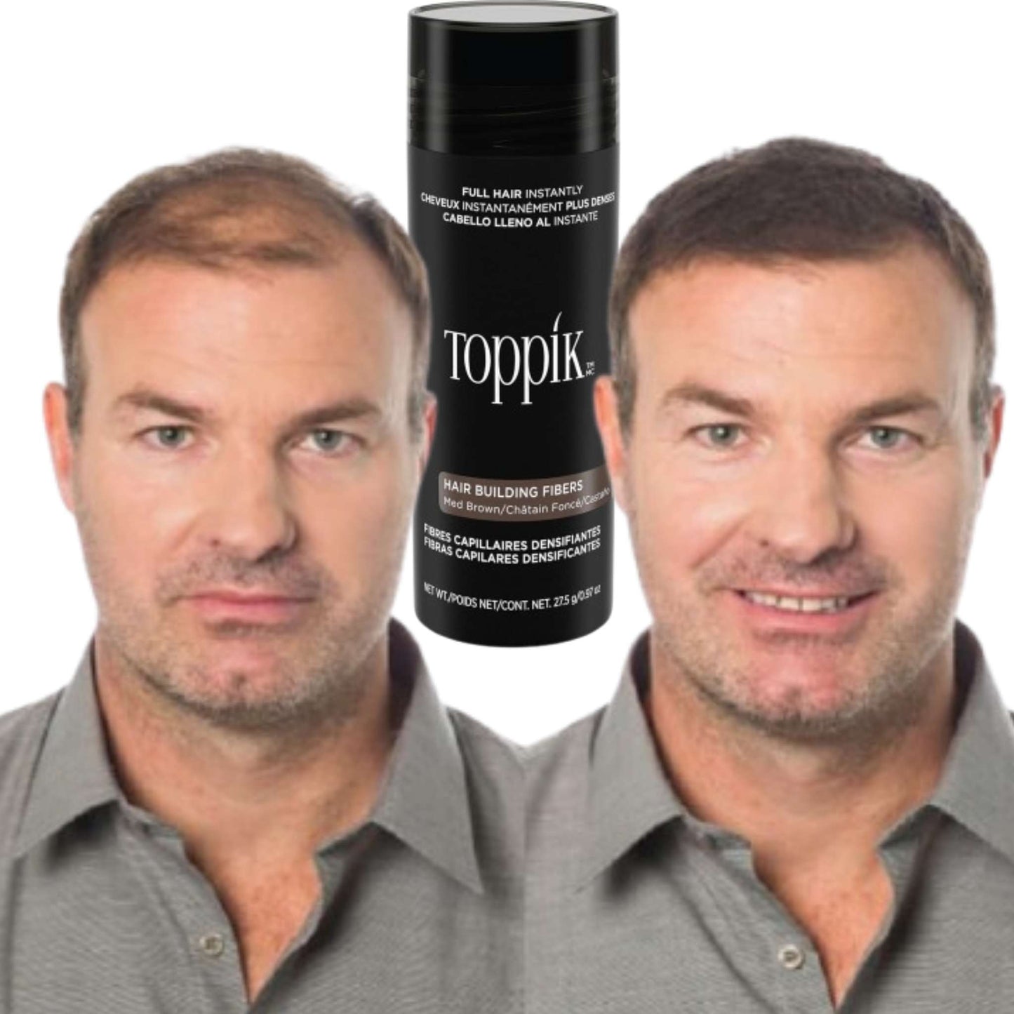 Ίνες Toppik για την ενίσχυση της πυκνότητας των μαλλιών – Αμέσως πιο πλούσια και πυκνά μαλλιά