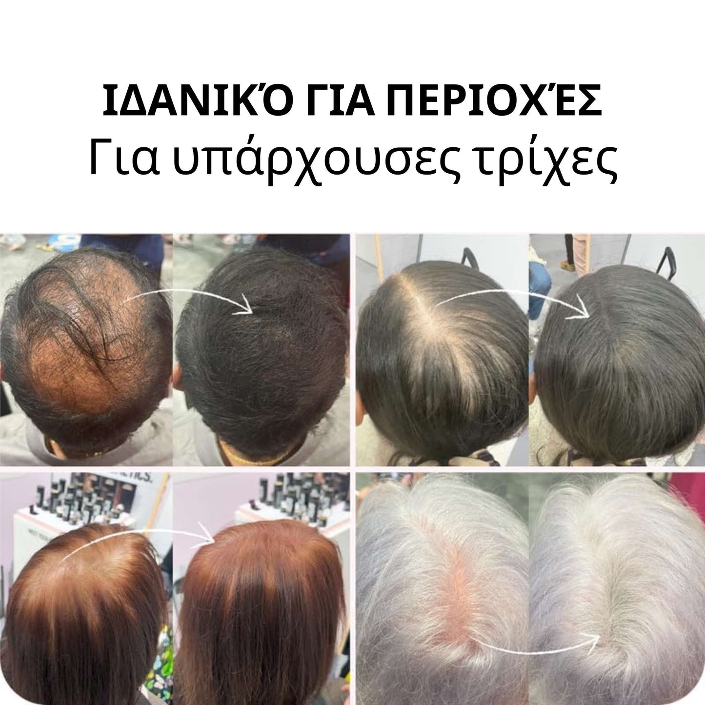 Ίνες Toppik για την ενίσχυση της πυκνότητας των μαλλιών – Αμέσως πιο πλούσια και πυκνά μαλλιά