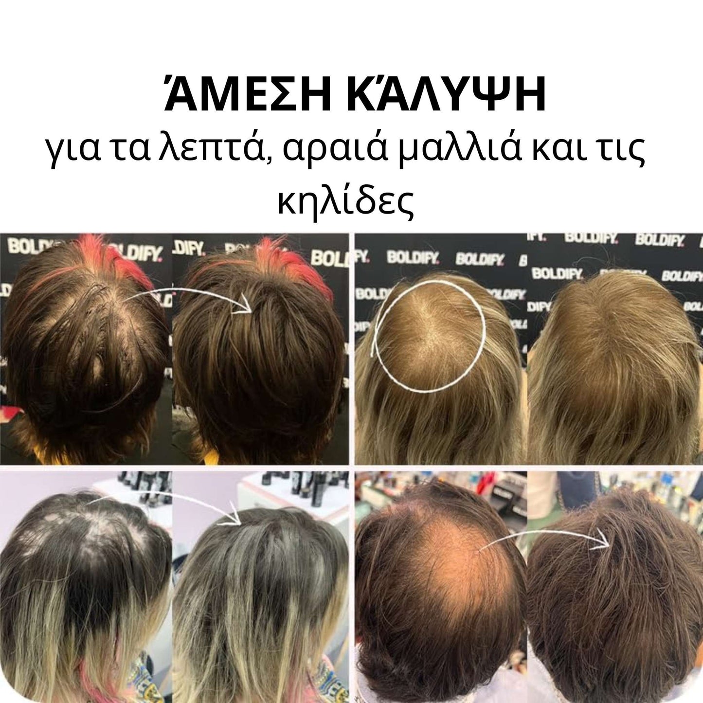 Ίνες Toppik για την ενίσχυση της πυκνότητας των μαλλιών – Αμέσως πιο πλούσια και πυκνά μαλλιά